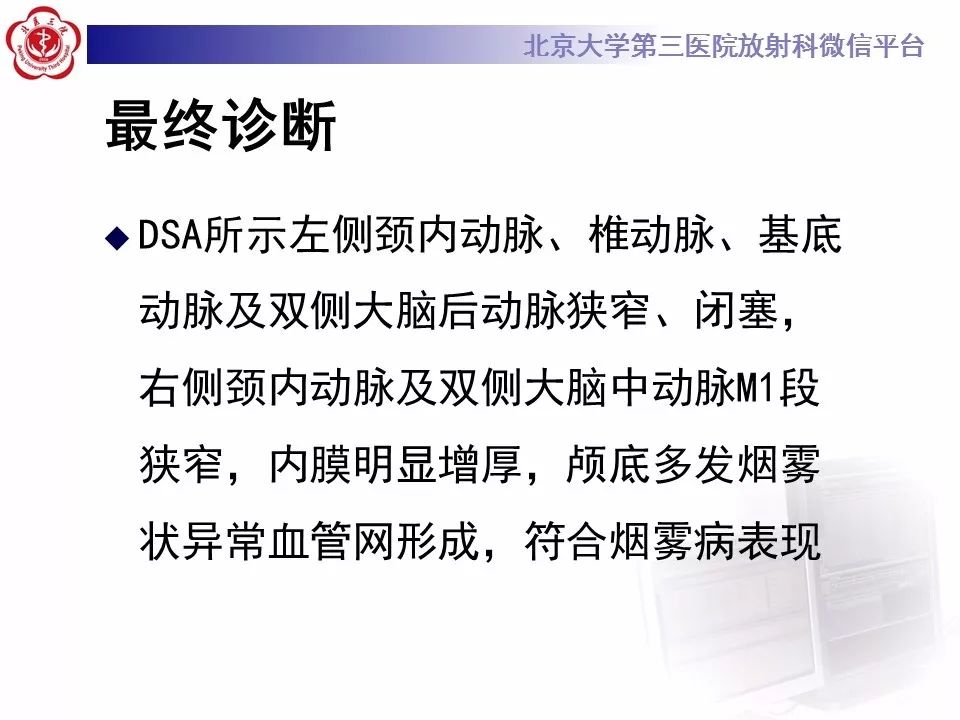 【病例】烟雾病1例CT及MR影像表现