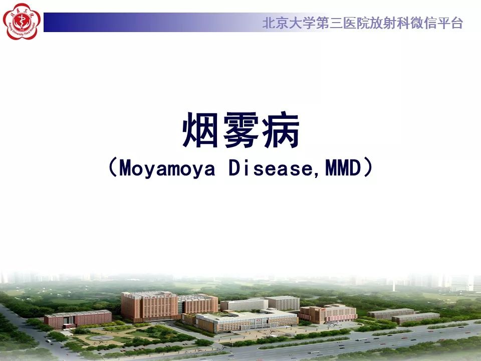 【病例】烟雾病1例CT及MR影像表现