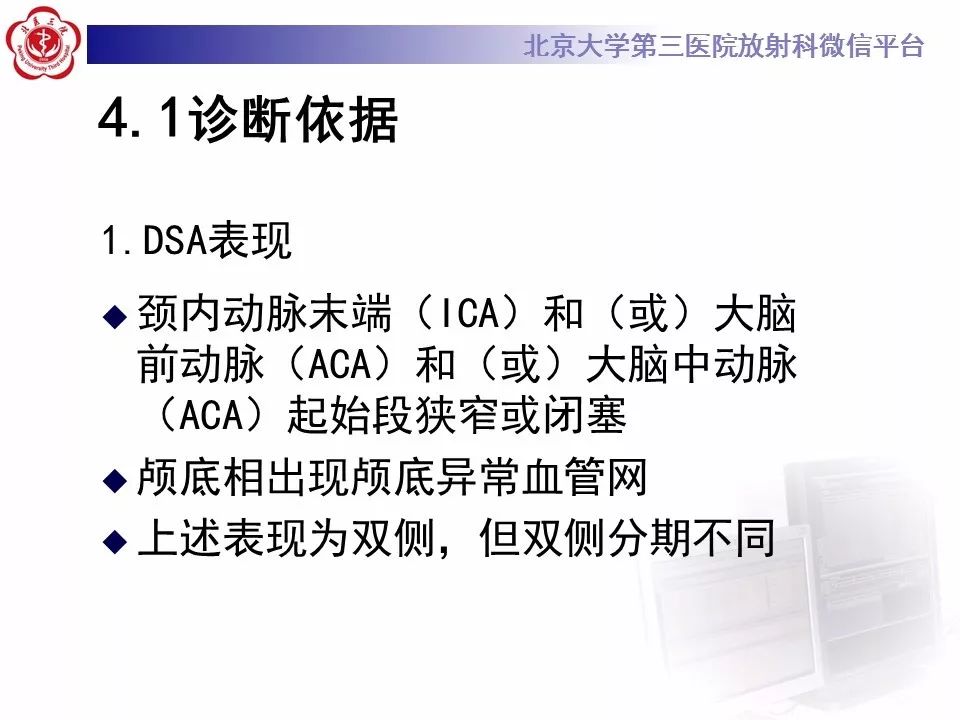 【病例】烟雾病1例CT及MR影像表现