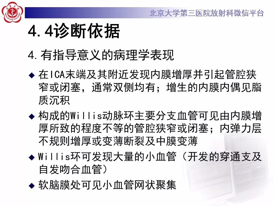 【病例】烟雾病1例CT及MR影像表现