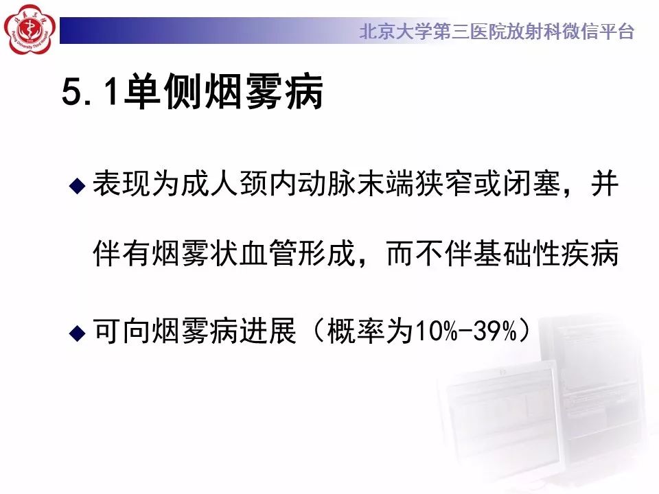 【病例】烟雾病1例CT及MR影像表现