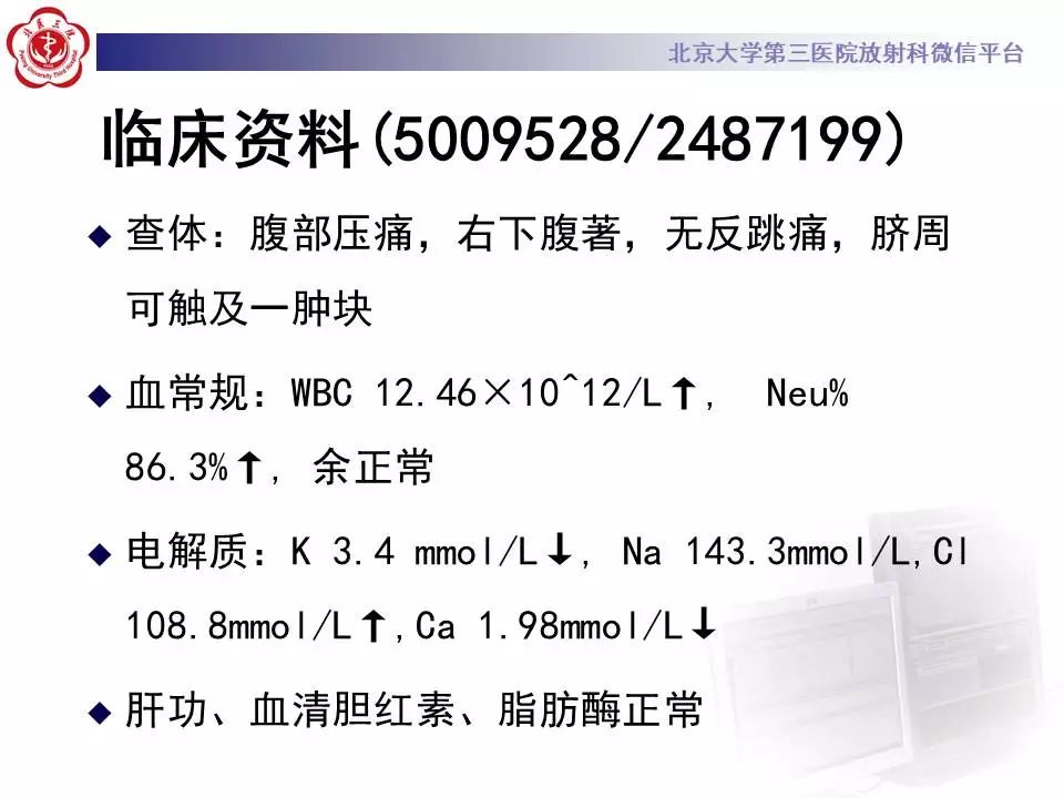 【病例】阑尾套叠1例CT影像表现