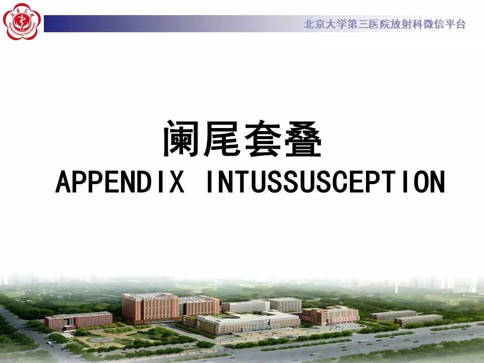 【病例】阑尾套叠1例CT影像表现