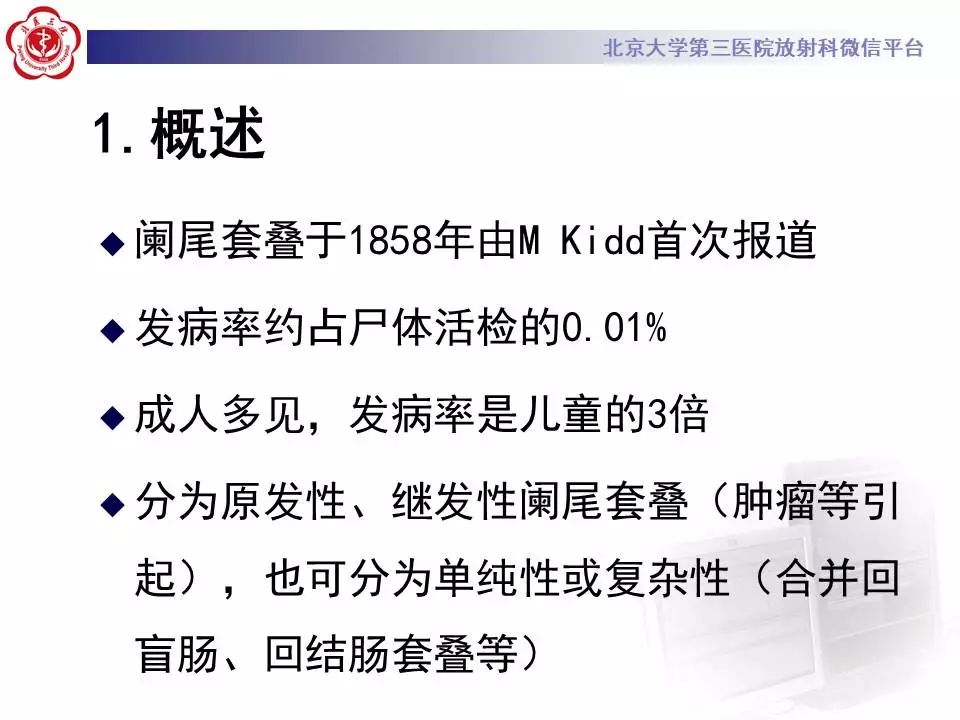 【病例】阑尾套叠1例CT影像表现