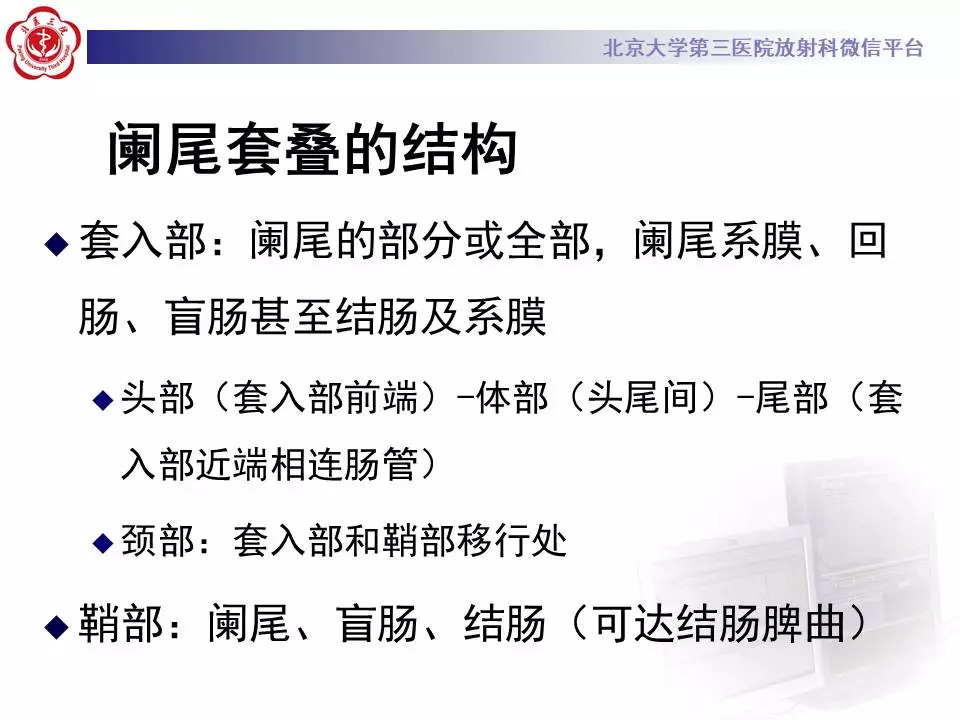 【病例】阑尾套叠1例CT影像表现