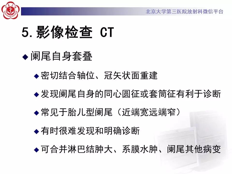 【病例】阑尾套叠1例CT影像表现