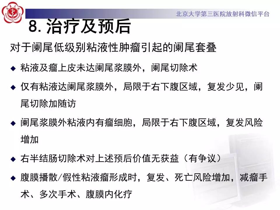 【病例】阑尾套叠1例CT影像表现