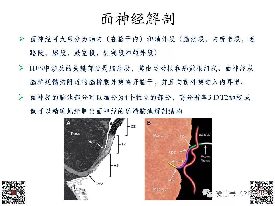 【PPT】神经血管压迫综合征的影像学表现