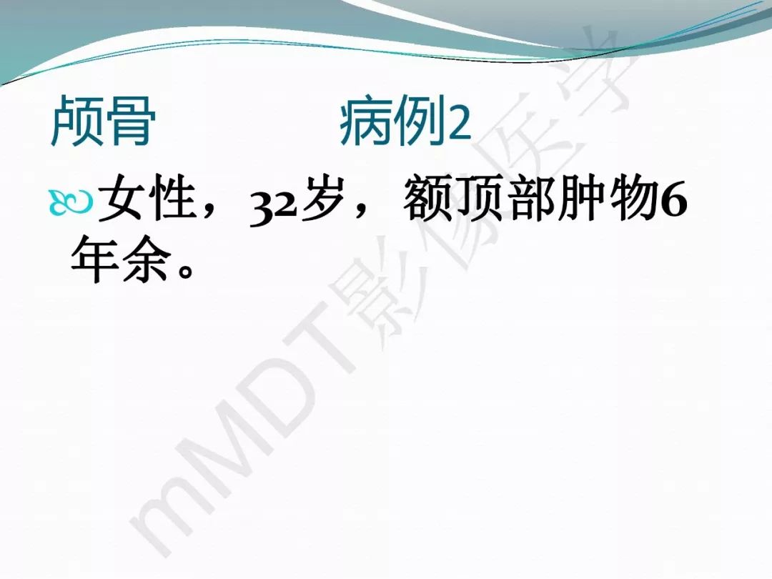 【PPT】骨嗜酸性肉芽肿（LCH）影像诊断及鉴别诊断