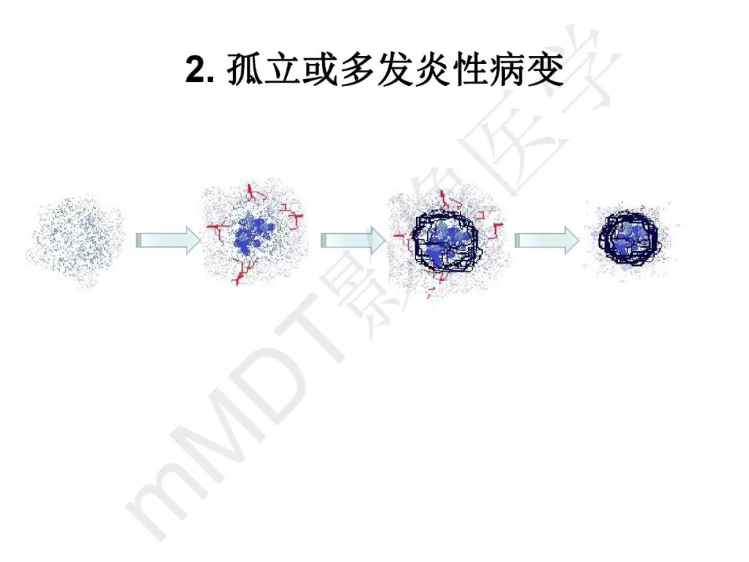 【PPT】纤维组织在肝脏炎性病变MR诊断中的价值