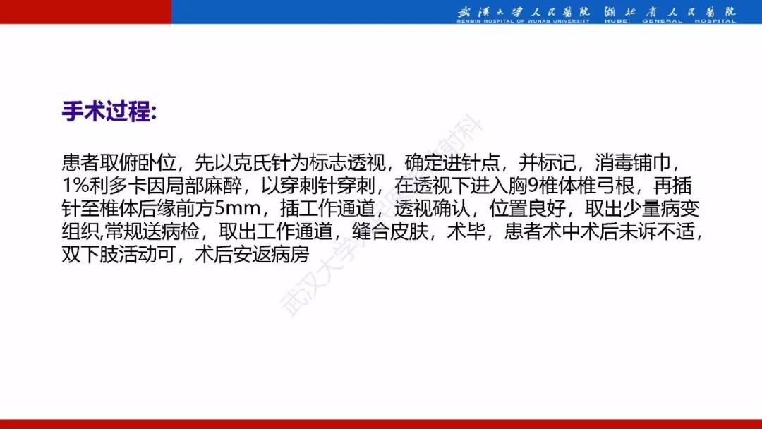 【PPT】脊柱孤立性浆细胞瘤影像诊断