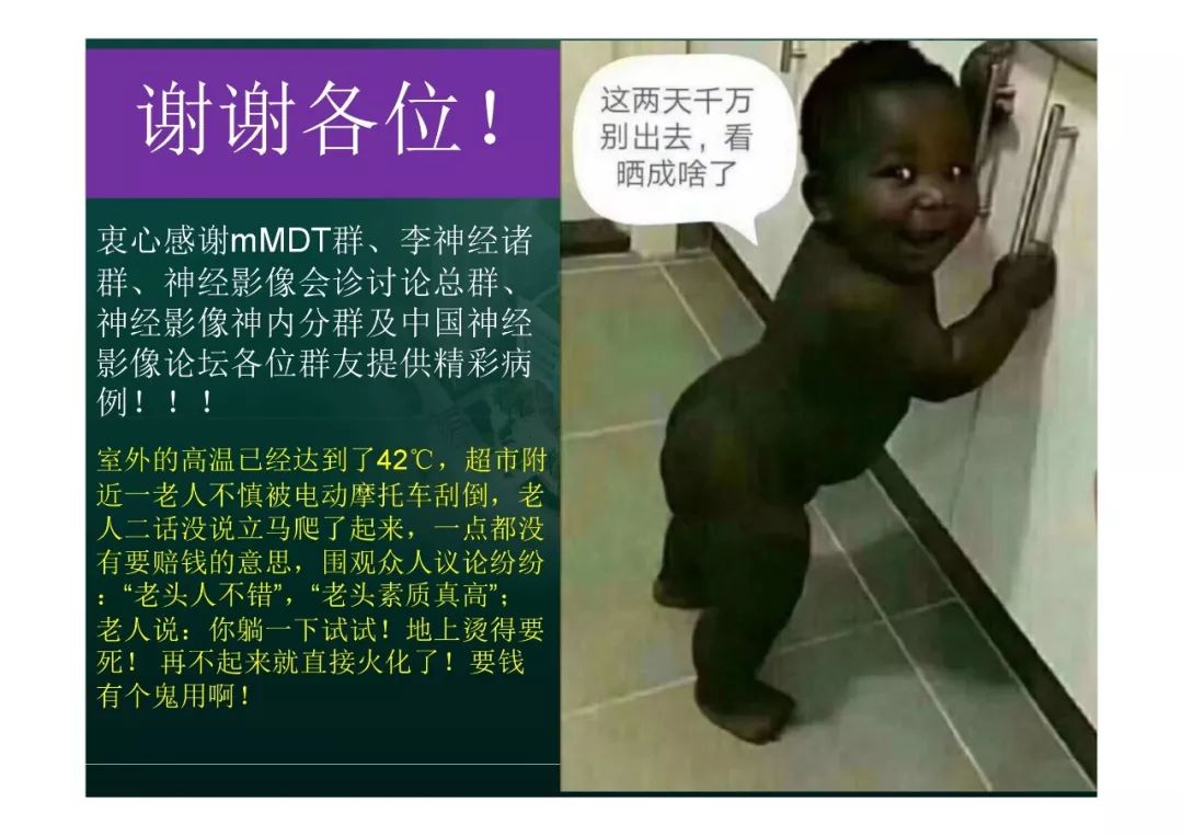 【PPT】临影结合看图识病之边缘脑区非肿瘤性病变