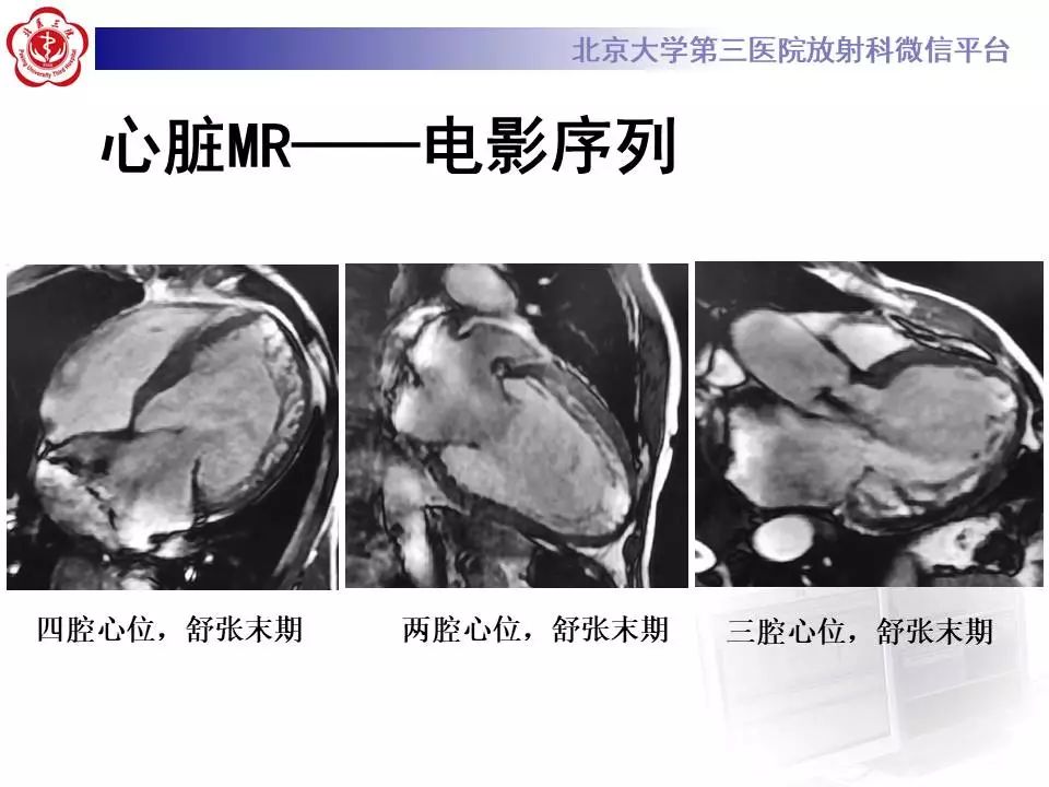 【病例】心肌致密化不全1例MR