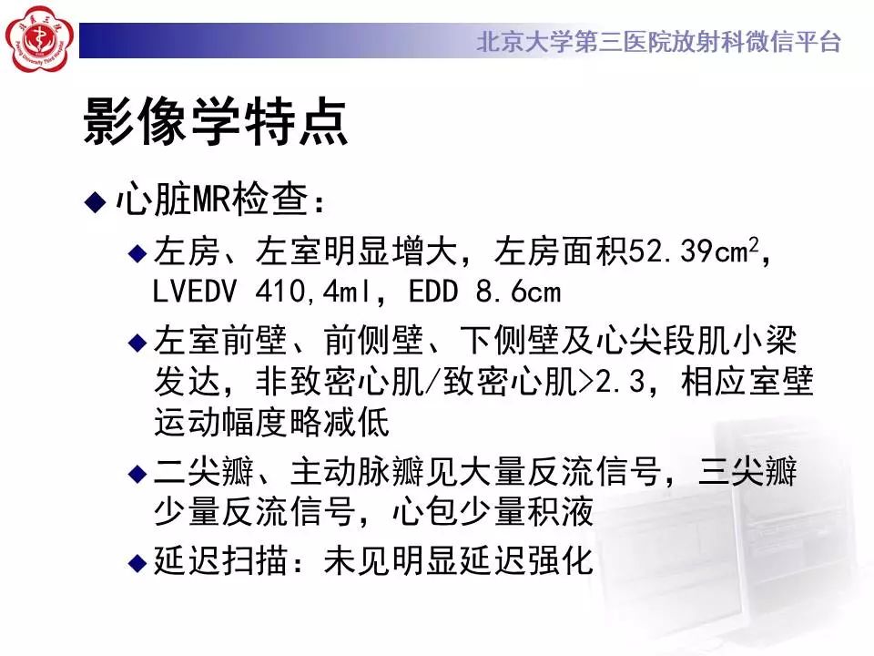 【病例】心肌致密化不全1例MR
