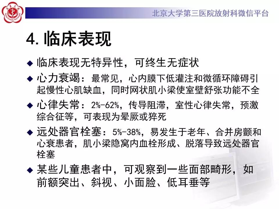 【病例】心肌致密化不全1例MR