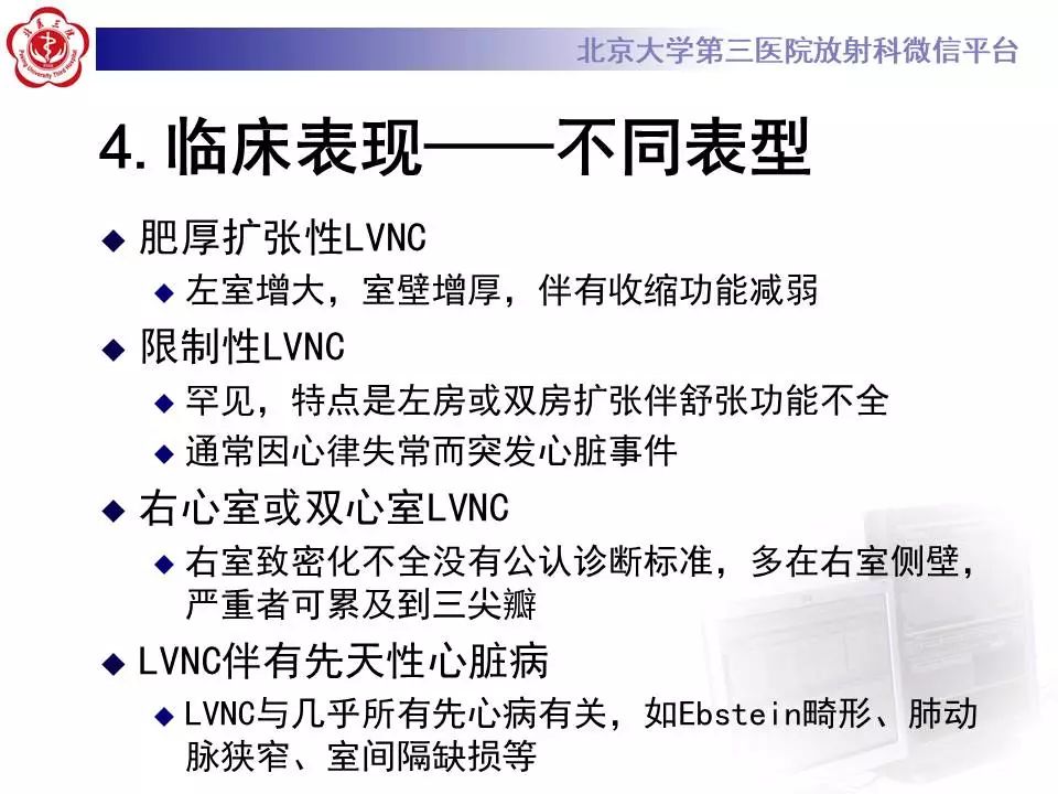 【病例】心肌致密化不全1例MR