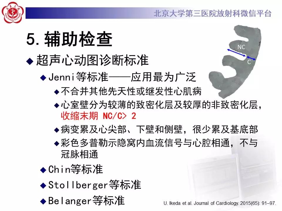 【病例】心肌致密化不全1例MR