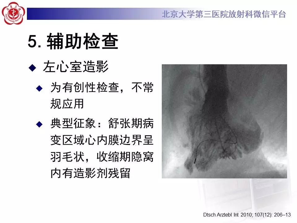 【病例】心肌致密化不全1例MR