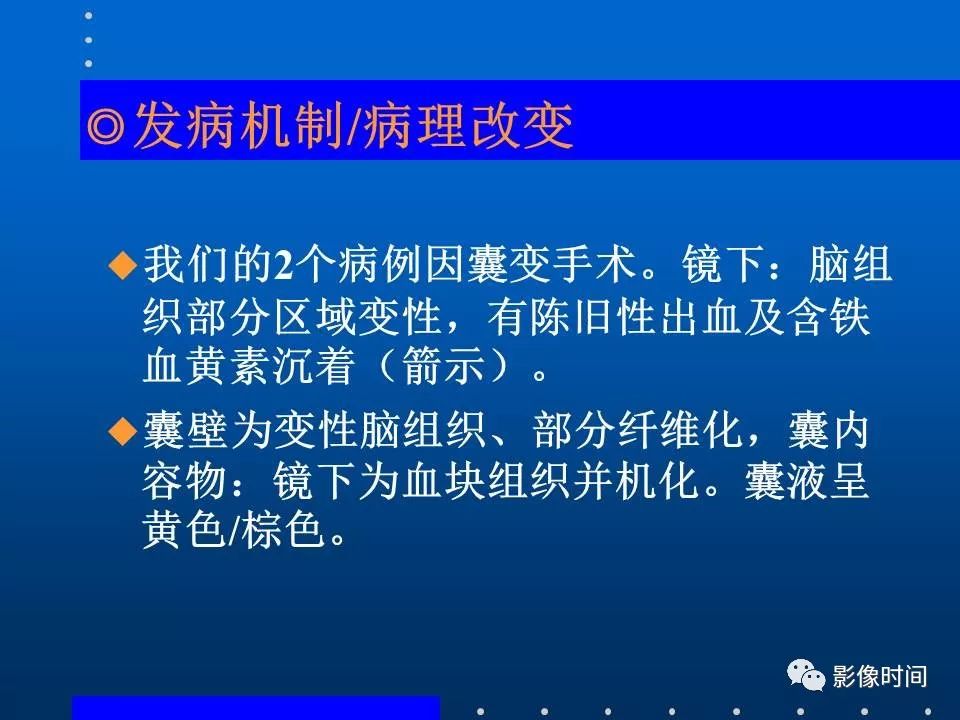 【PPT】Fahr病临床影像诊断与鉴别诊断