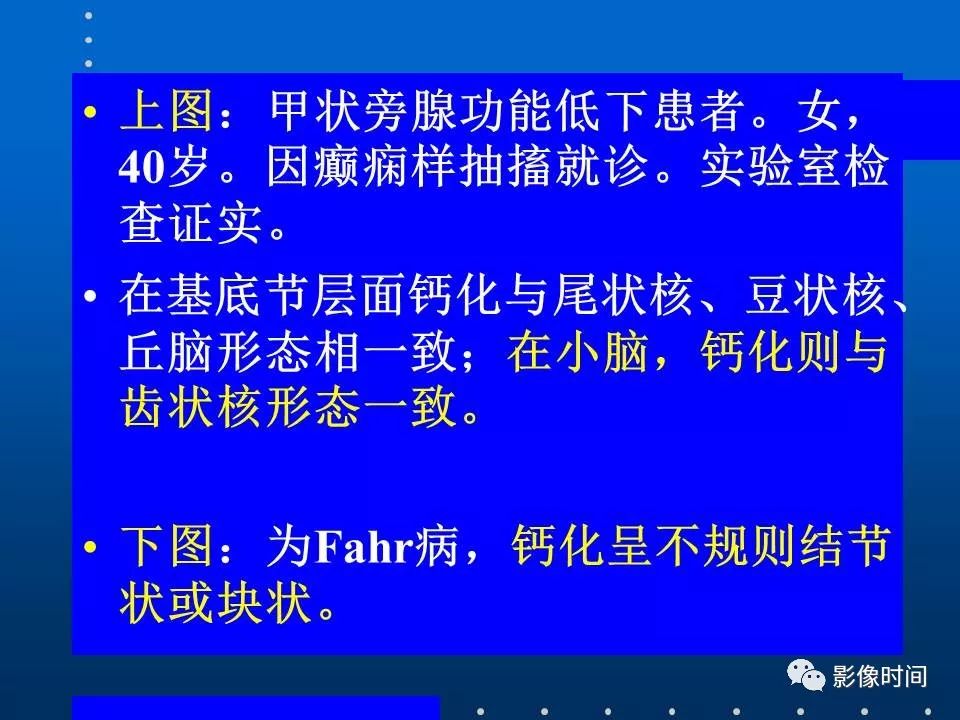 【PPT】Fahr病临床影像诊断与鉴别诊断