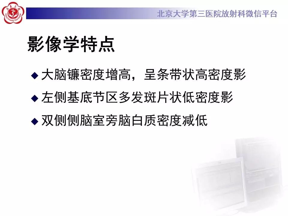 【病例】大脑镰硬膜下血肿1例CT及MR