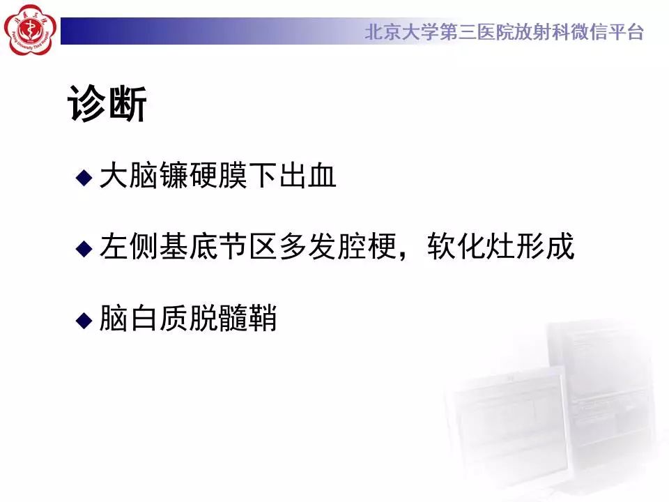 【病例】大脑镰硬膜下血肿1例CT及MR