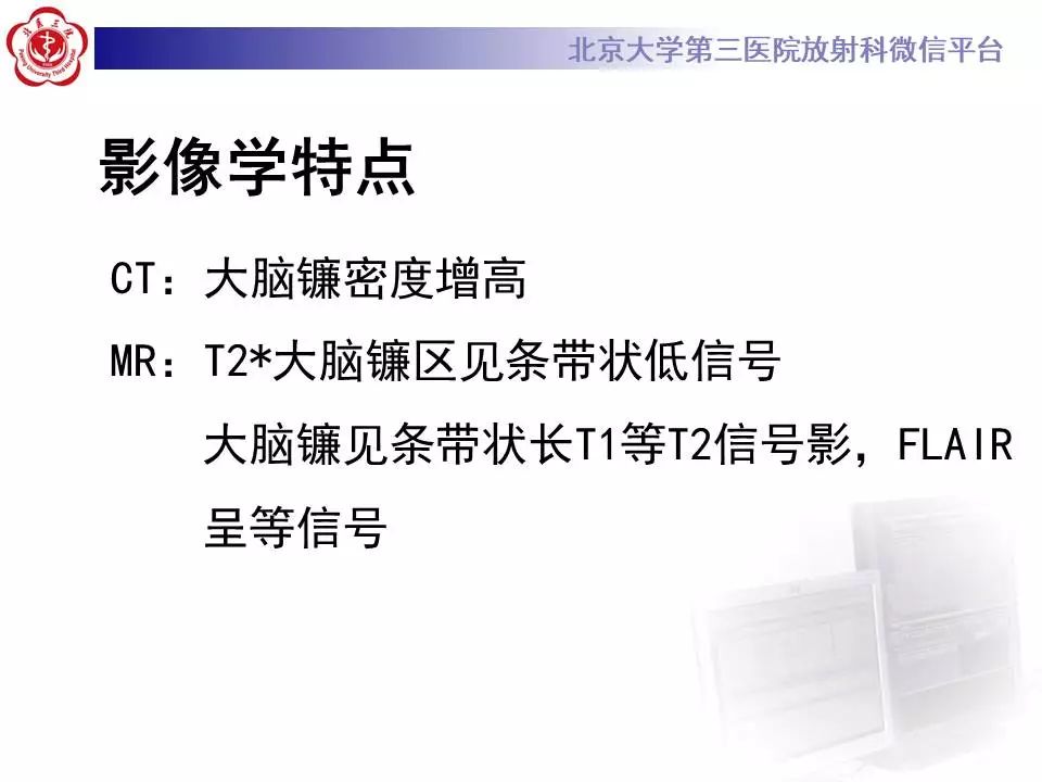 【病例】大脑镰硬膜下血肿1例CT及MR