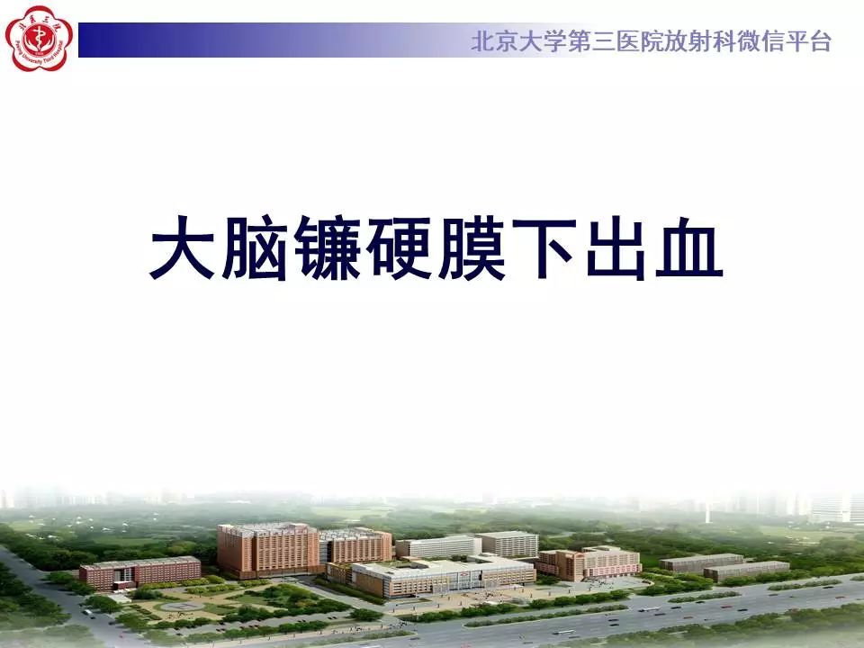 【病例】大脑镰硬膜下血肿1例CT及MR