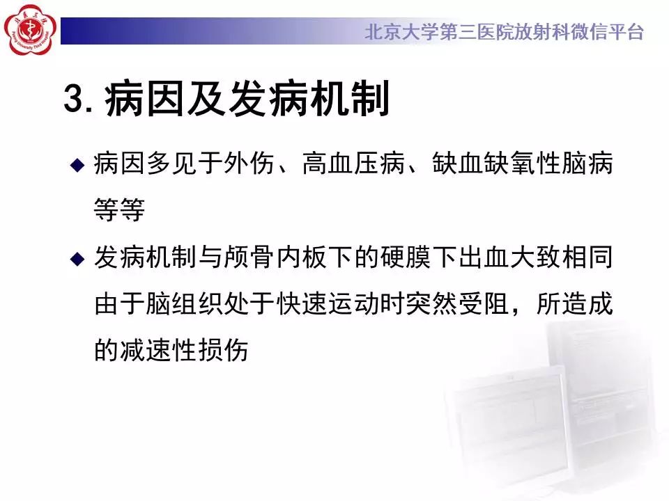 【病例】大脑镰硬膜下血肿1例CT及MR