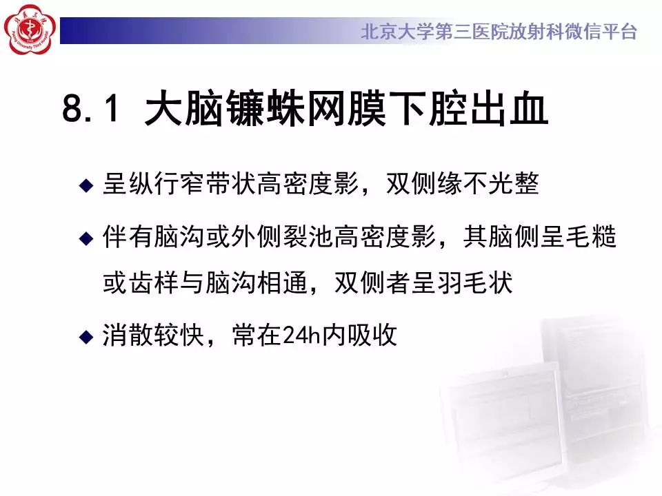 【病例】大脑镰硬膜下血肿1例CT及MR