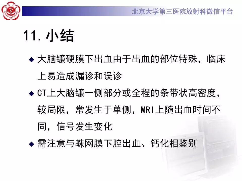 【病例】大脑镰硬膜下血肿1例CT及MR