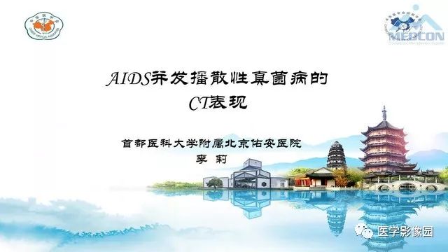 【PPT】AIDS并发播散性真菌病的CT表现