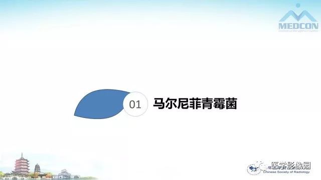 【PPT】AIDS并发播散性真菌病的CT表现