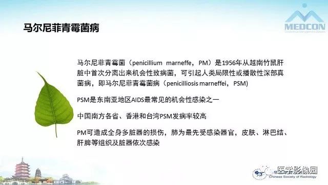 【PPT】AIDS并发播散性真菌病的CT表现