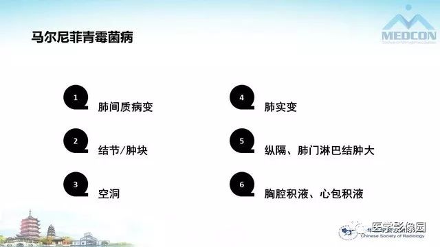 【PPT】AIDS并发播散性真菌病的CT表现