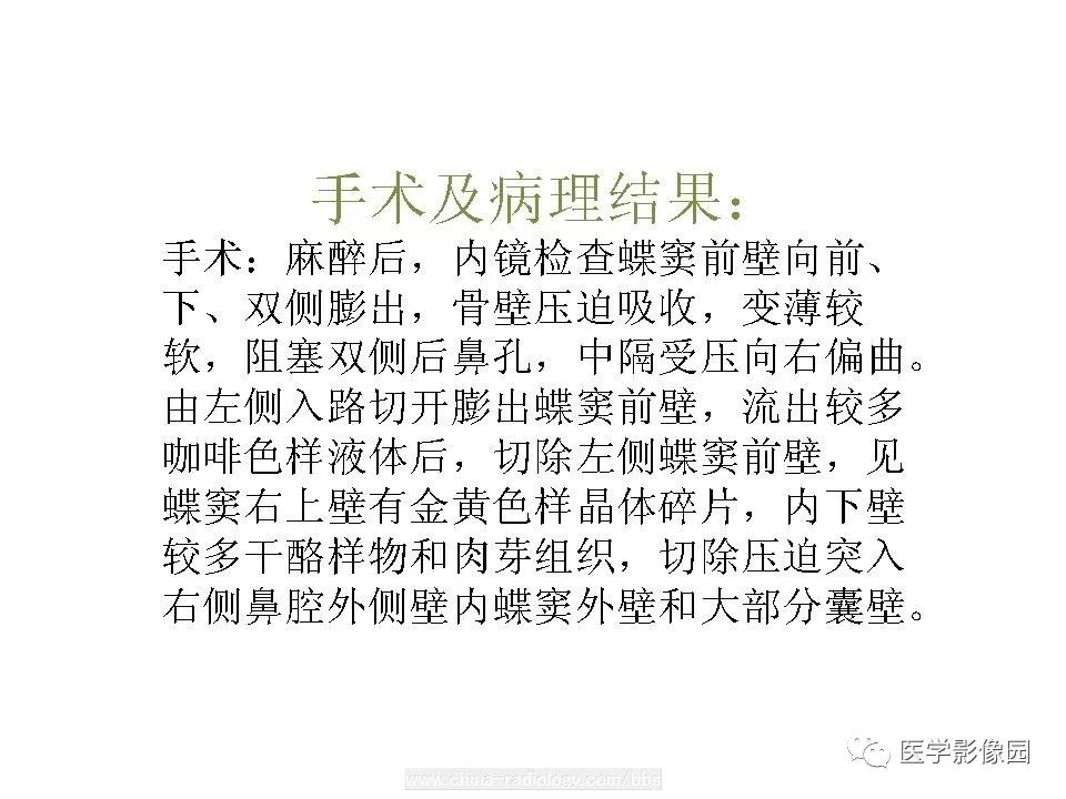 【病例】蝶窦颅咽管瘤1例CT及MR影像表现