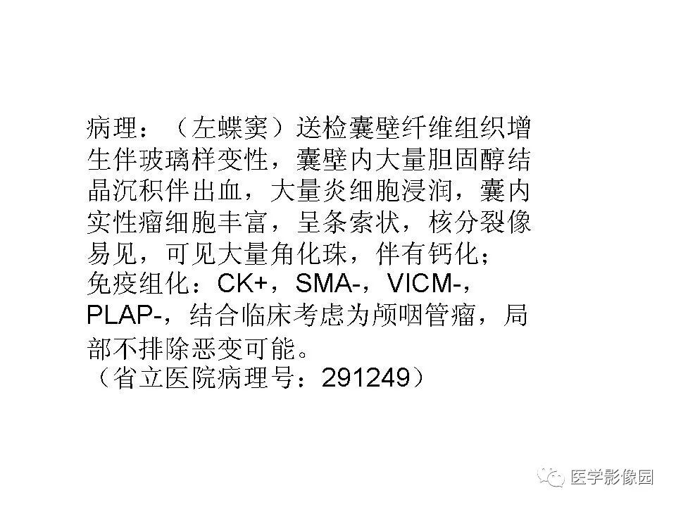 【病例】蝶窦颅咽管瘤1例CT及MR影像表现