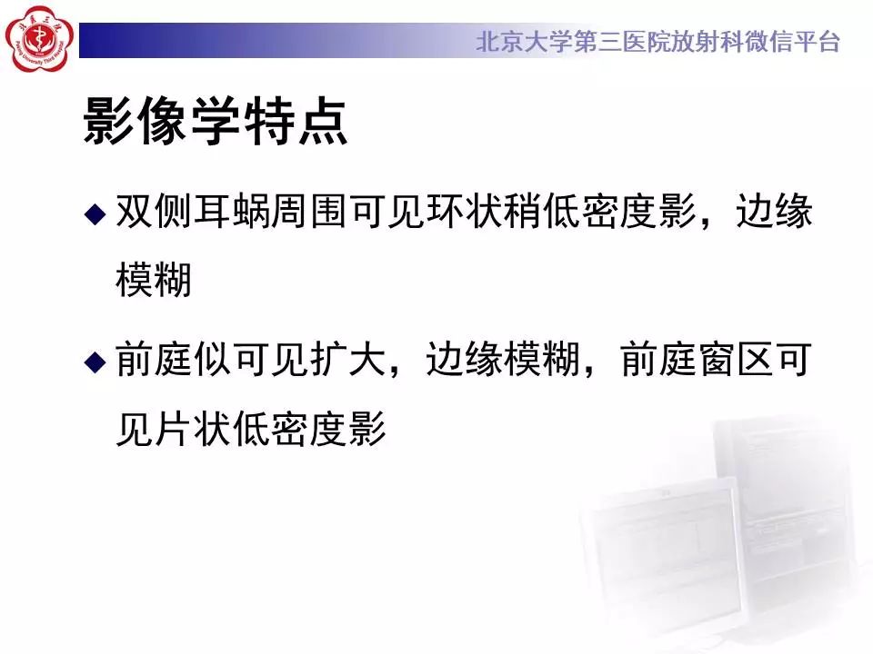 【病例】耳硬化症1例CT影像表现