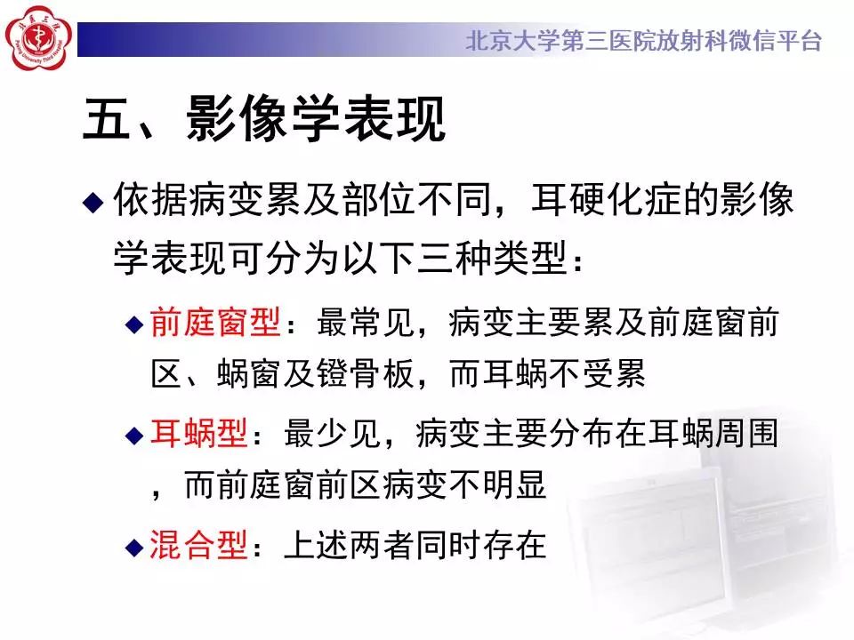 【病例】耳硬化症1例CT影像表现