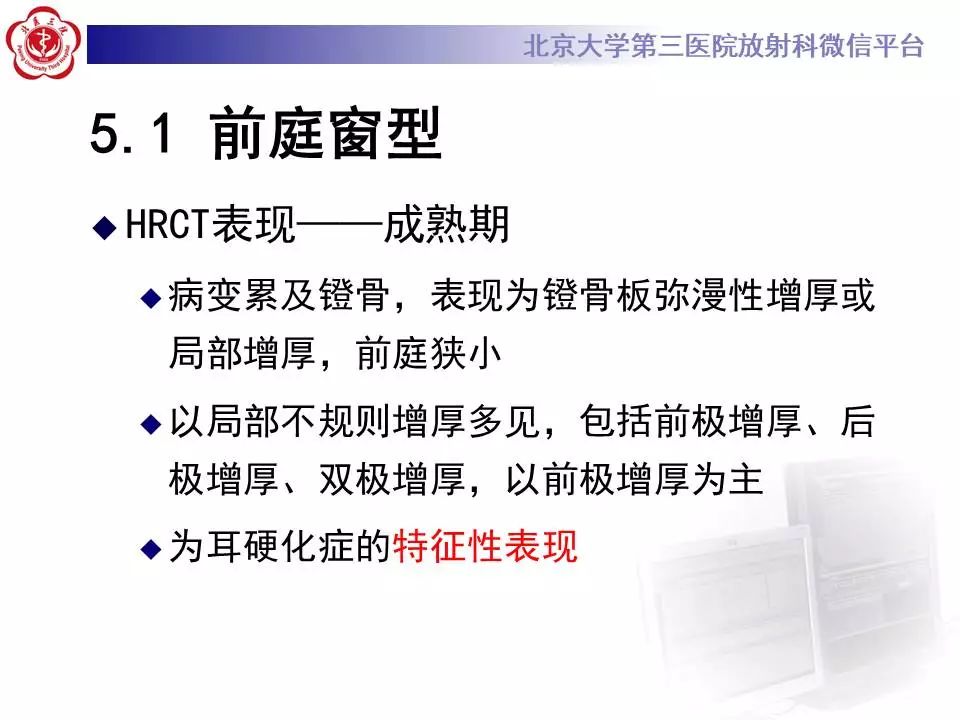 【病例】耳硬化症1例CT影像表现