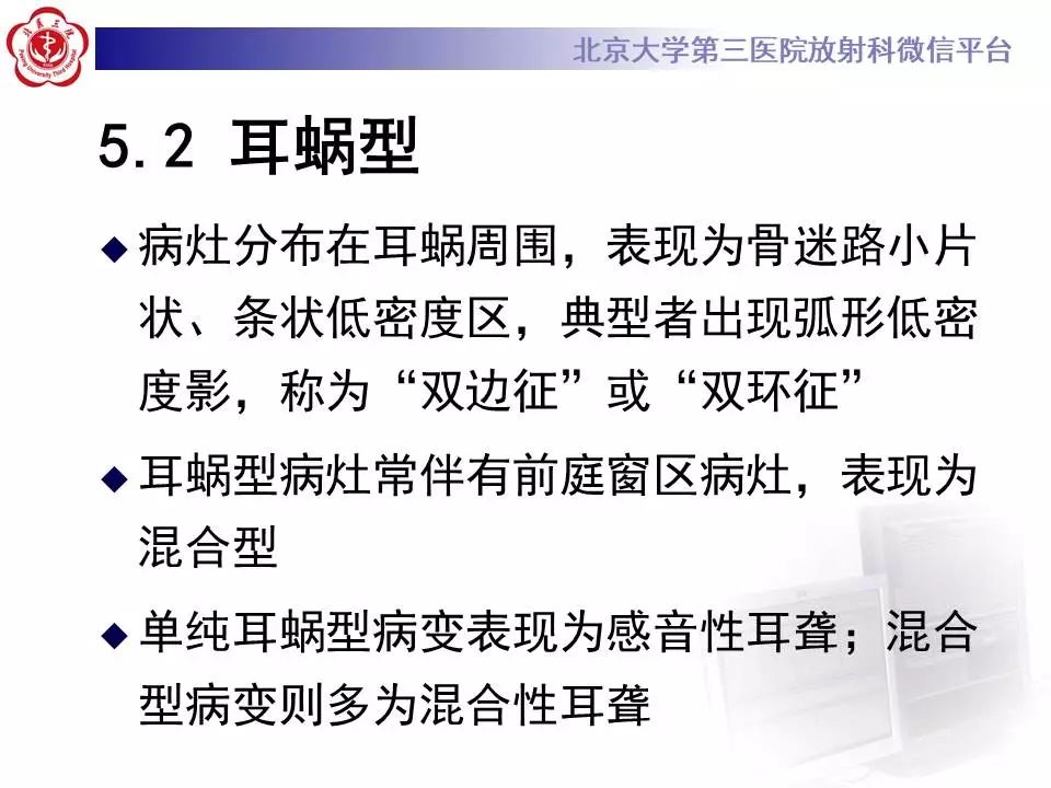【病例】耳硬化症1例CT影像表现