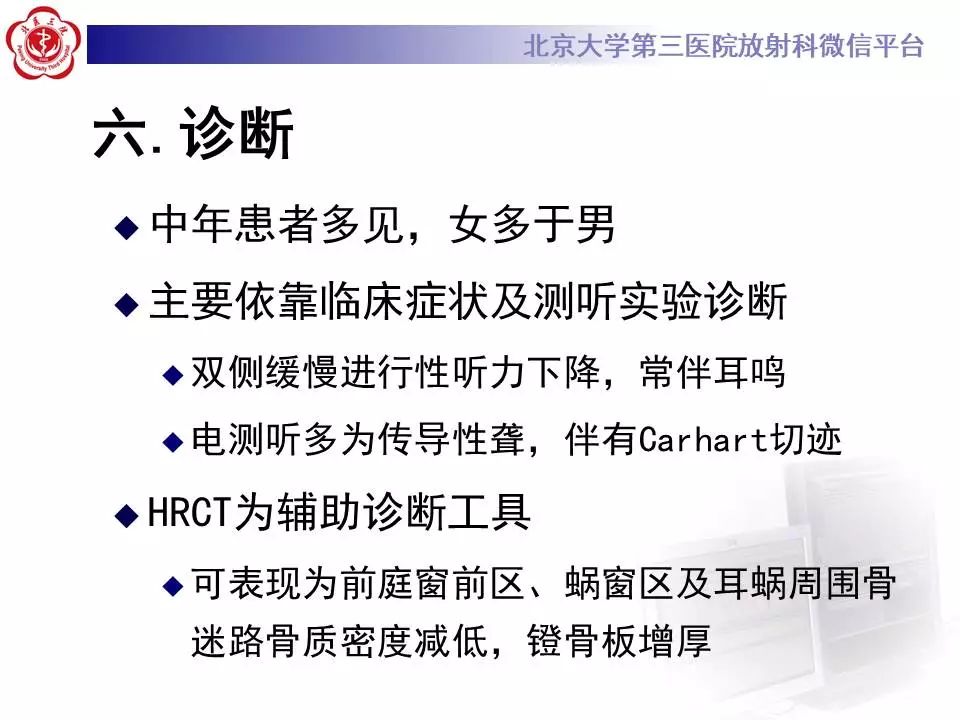【病例】耳硬化症1例CT影像表现