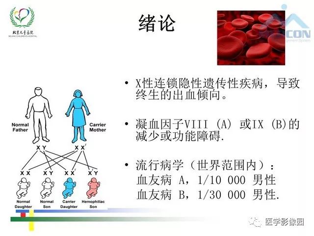 【PPT】儿童血友病性骨关节病的影像评估与策略
