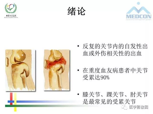 【PPT】儿童血友病性骨关节病的影像评估与策略