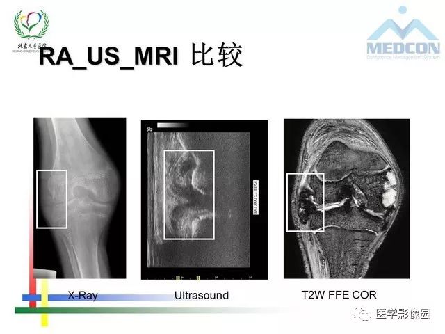 【PPT】儿童血友病性骨关节病的影像评估与策略