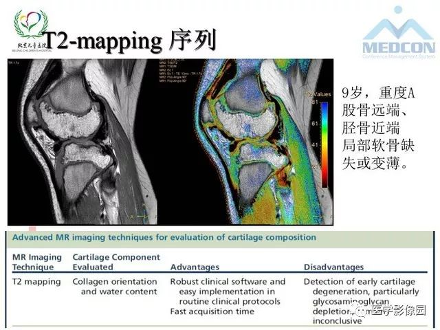 【PPT】儿童血友病性骨关节病的影像评估与策略