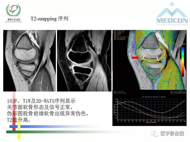 【PPT】儿童血友病性骨关节病的影像评估与策略