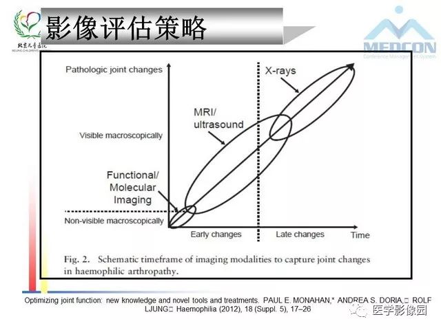 【PPT】儿童血友病性骨关节病的影像评估与策略