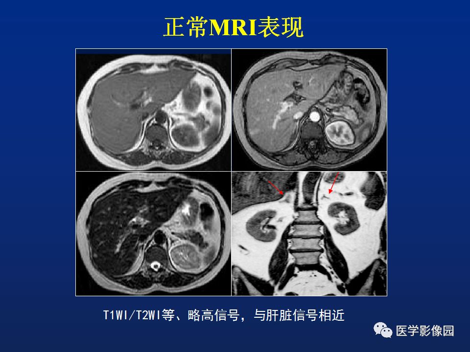 【PPT】肾上腺疾病的影像学表现