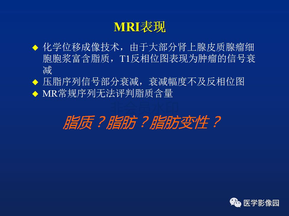 【PPT】肾上腺疾病的影像学表现